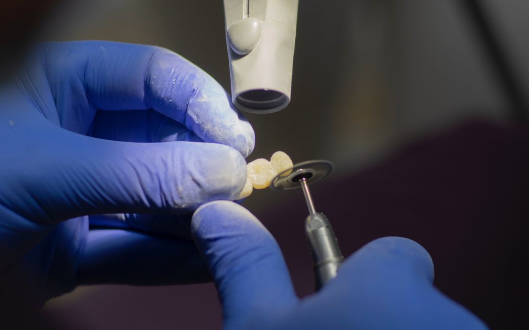 Interceptive Orthodontics: A Milestone In Dentistry