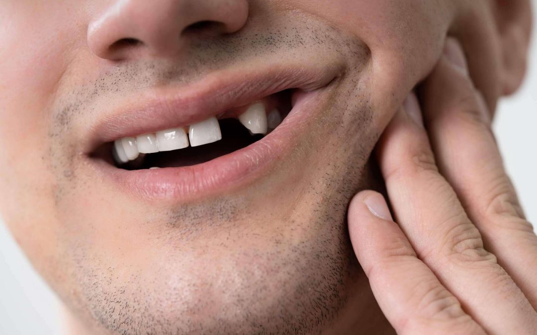 Missing Teeth Can Be Devastating: Dental Implants Are the Fix